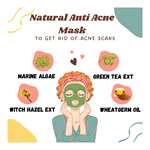 Vigini 45Percent Actives Anti Acne Clay Face Facial Pack Mask